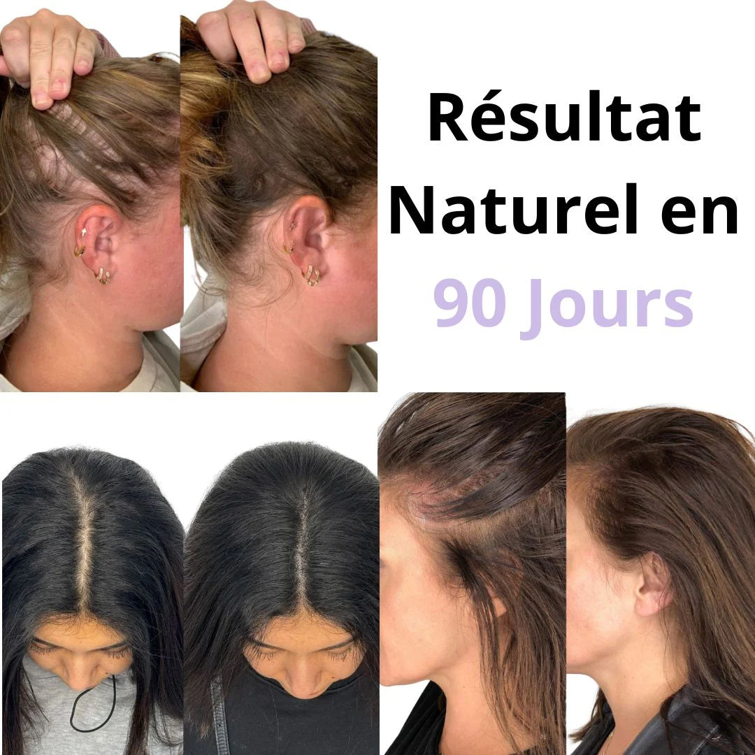 TheraBrush™ Massage Ultime 4 en 1